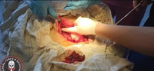 War injuries compilation