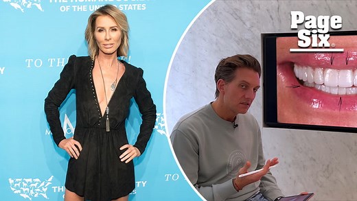 Carole Radziwill gets $110k smile makeover