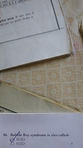 Bubble Boy syndrome is also called-(A) SCID(C) STID... | Filo