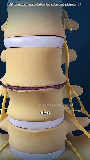 Lumbar Disc Replacement Surgery (3D Animation)#lumbardiscreplacement #lumbardischerniation