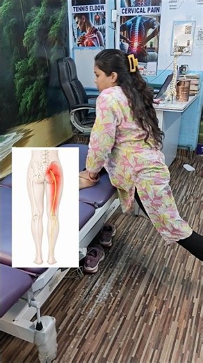 Piriformis Syndrome Treatment Exercise | Sciatica Relief Stretch