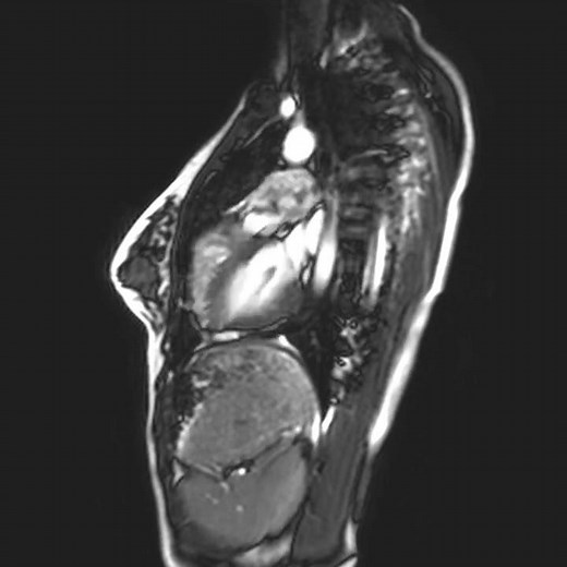 Heart MRI with sound