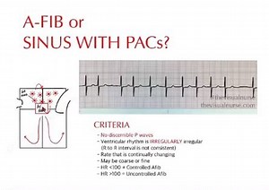 12K views · 196 reactions | @thevisualnurse has some of the best...