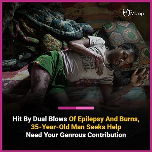 61K views · 1.1K reactions | I got a seizure and fell down. One moment, I was standing in front of the choolha (floor of furnace), and the next, I was feeling a burning sensation on my skin. I had no control of my body, and I didn’t know what happened. I couldn’t even cry out for help and sustained Third degree burns. Everything went blank after that. I was the sole breadwinner of my family and now I am completely dependent on my wife. | Milaap | Facebook
