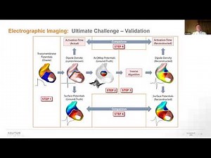 Graydon Beatty (Acutus) - Advantages and Challenges in Inverse Reconstruction of Cardiac Sources