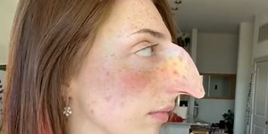 Woman goes viral for blasting offensive 'hooked nose' TikTok trend