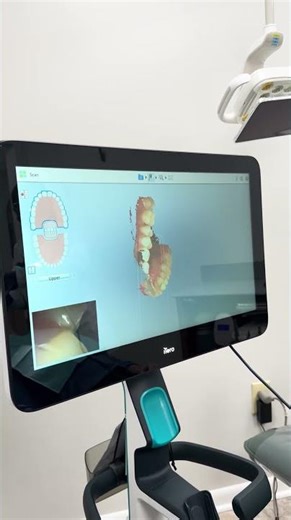 Modern Goop Free Dental Impression!