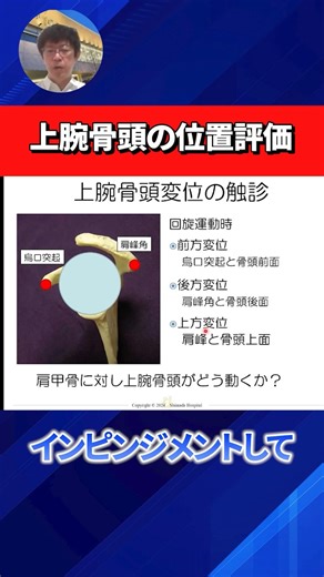 [Are you correctly assessing the humeral head?] Treatment points to improve shoulder impingement ...