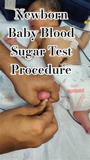 Newborn Baby Blood Sugar Test Procedure #ytshorts #premature #newbornbaby #cute