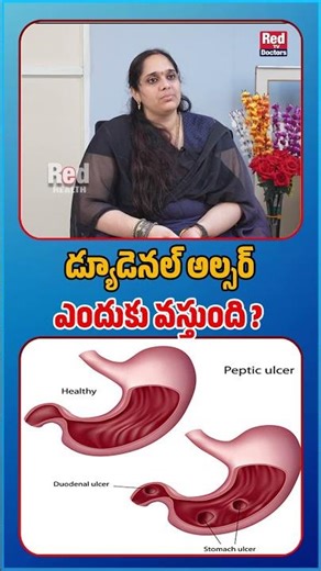 Why does duodenal ulcer occur? | REDTV Doctors