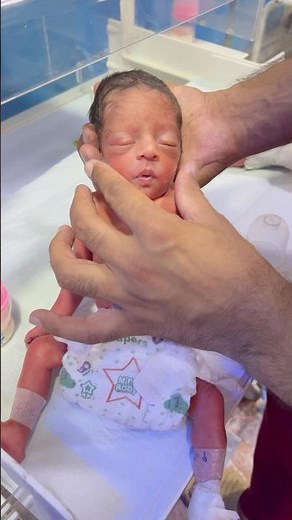 Preterm Baby Showing Great Improvement in Our NICU – A Journey of Hope #neonatal #prematureinfants
