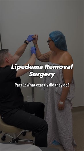 Katie Tarr • Lipedema • Lymph Tips • Low-Tox Living on Instagram: "I had lipedema removal surgery at the Advanced Lipedema Treatment Center with Dr. David Smart in Salt Lake City, Utah last October on my lower legs + arms. Dr Smart performed lymph-sparing, water-assisted liposuction specifically designed for lipedema tissue. Here’s what that actually means: • The goal was to remove diseased, fibrotic fat cells that do not respond to diet or exercise (trust…I tried everything for 5+ years) • Spec