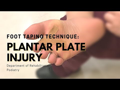 Foot Taping Technique: Plantar Plate Injury