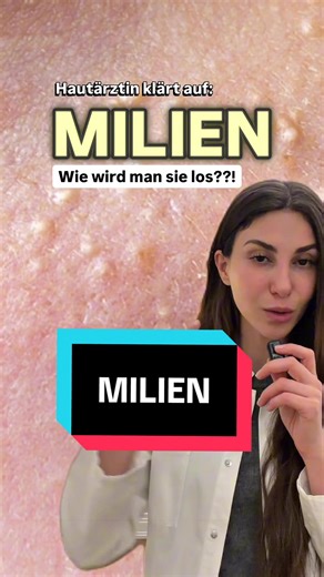 Das sind meine Tipps und Tricks gegen Milien. Was ihr übrigens auch tun könnt, was ich hier vergessen habe zu erwähnen: Versuchen sie bei einer Kosmetikerin zu entfernen. Erfahrene Kosmetikerinnen können das auch gut. Sie tendieren dann nur gern dazu wiederzukommen. Meine Erfahrung ist, dass es mit einem CO2 Laser am besten weggeht, allerdings auch nicht jeder Hauttyp dafür geeignet ist und man schon ungefähr 7-10 Tage eine kleine Schürfwunde hat. Bei skincare: niacinamid, aha, bha und pha wirke