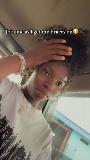 Braces Journey: My Experience Getting Them On