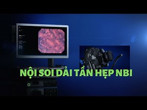 NBI Narrow Band Endoscopy and JNET classification