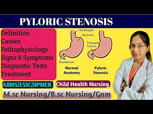 Pyloric Stenosis | Pediatrics | Projectile Vomiting | Causes | Pathophysiology | Treatment