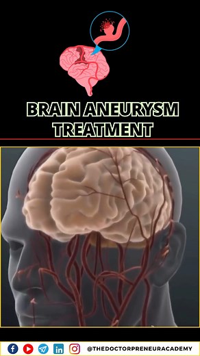 13K views · 76 reactions | A patella fracture means a broken kneecap...