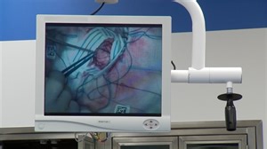 Neurostimulation innovations for epilepsy - Mayo Clinic