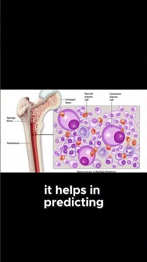 "Beta-2 Microglobulin: The Hidden Cancer Clue 🔬 | Tumor Marker Explained Fast!" #bloodtest #cancer