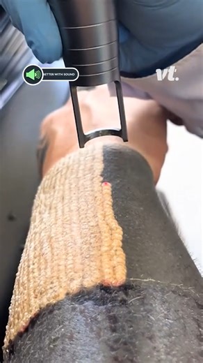 That’s gotta be seriously painful 😳 | VT