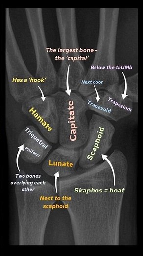 Carpal Bone Anatomy in 15 Seconds 🦴 | Wrist X-ray Explained #Shorts #carpal