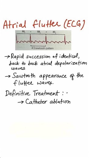 Atrial flutter|ECG interpretation #shorts #ecg