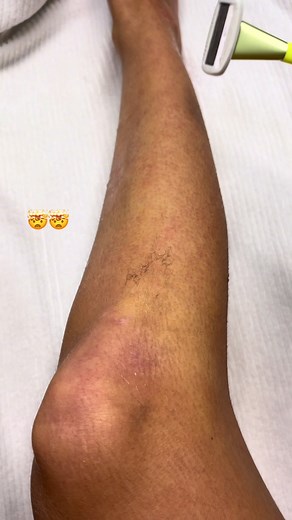 Effective Shaving Hack to Achieve Smooth Skin