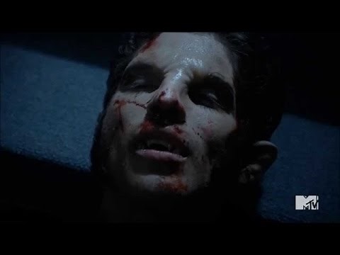 Teen Wolf 5x10 - Scott Turns Back From Dead "Scott Roar"