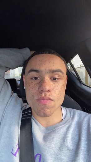 Close-Up Freckles Lemonade Leak Inside the Car Video
