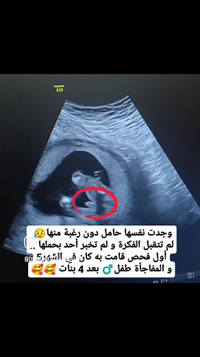 نصائح للحمل والولادة: انتظر صبياً بعد 4 بنات