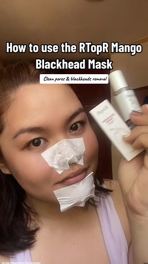 RTopR Mango Blackhead Mask - Blackheads Removal Tutorial