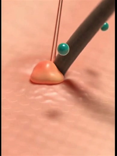 Ce que vos serviettes contiennent après la douche #sante #santénaturelle #bienetre