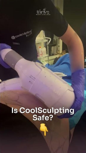 Is CoolSculpting Safe?