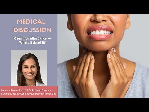 Rise in Tonsillar Cancer—What’s Behind It?