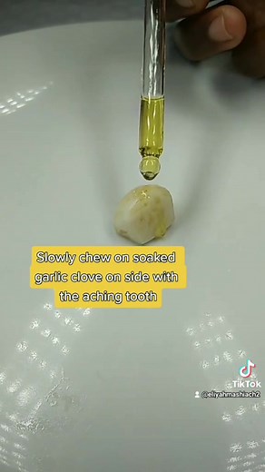 Natural Remedies for Toothache Relief