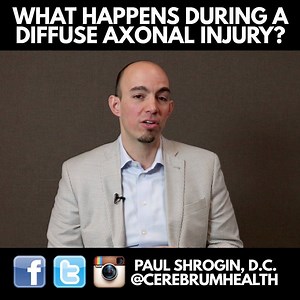 During a DAI or Diffuse Axonal Injury, movement causes the axons to stretch or sheer and when this occurs throughout the whole cortex, that is when it becomes a “diffuse axonal injury.” #DAI #axonal #diffuse #braininjury #TBI | Cerebrum Health Centers, A National Institute for Brain Treatment