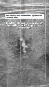 🌀 What if frequency was more than you ever thought it was? Not just sound… not just vibration… but a direct influence on your biology. At the University of Michigan, researchers used focused sound waves to break down disease tissue .. no scalpel, no radiation. Just energy. This isn’t exactly what we do at iPyramids… but it’s a powerful confirmation: Frequency affects the body more than most people realize. Our PEMF (Pulsed Electromagnetic Field) systems are designed to hit you at a cellular lev