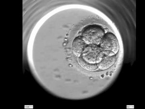 Human embryo growth under microscopic time lapse photography