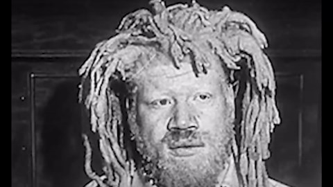 The Black Brothers Who Were Kidnapped By The Circus