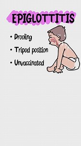Code HAVIC @medschoolbro = Mystery Discount Pediatric Upper Airway 👶 Croup • Viral • Seal-bark cough inspiratory stridor • Treat with steroids ± racemic epi 🚨 Epiglottitis • Drooling, tripod position, toxic child • Thumbprint sign • Secure the airway 🧠 Pearls • Sudden cough unilateral wheeze → foreign body • Stridor worse supine, better prone → laryngomalacia Stridor questions = easy Step points if you know the clues. #drhavicandbrody #medstudent #usmle #step1 #pediatrics #airway #highyield #