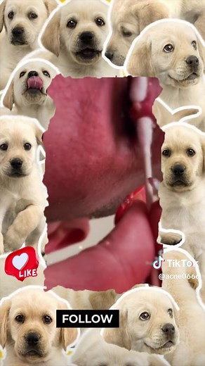 Acne Removal P.R on TikTok