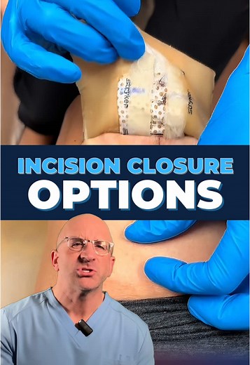 Skin Closure Techniques: Sutures, Staples, and Zipline