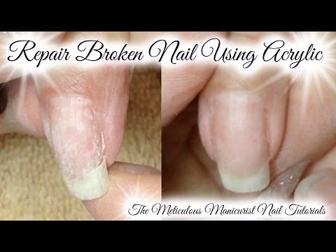 Acrylic Nail Tutorial: How To Repair or Patch Broken Natural Nail