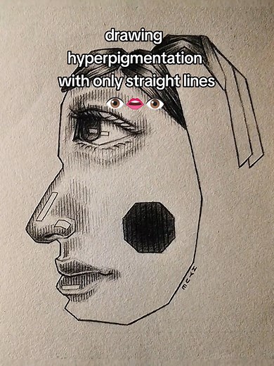 Drawing hyperpigmentation with only straight lines✨ #hyperpigmentation #art #drawingmeme #drawing #funny #meme #funnymeme #viral #viralmeme #viralfunnyvideo