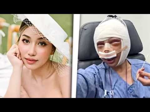 The transformation that shocked the internet: she had surgery to be on par with her boyfriend