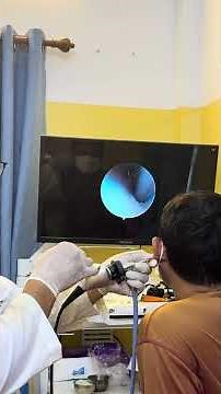Professional Earwax Suction 😳 | Deep Canal Cleaning Results #entclinic #viralvideo #health