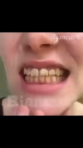 🦷 Gum Healing Breakthrough — No Pain, Just Results! Suffering from bleeding gums or sensitivity? 😣 Biancat® BeeRenew Advanced Gum Healing Toothpaste combines bee venom peptides and regenerative compounds to repair, strengthen, and restore gum health — naturally. ⬇️ Try it now ⬇️ https://www.wjhhia.com/products/toothpaste1 | Weruop.fa