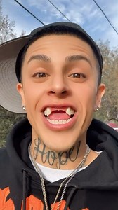 70K views · 8K reactions | Toothless but happy! Although, let’s be honest… a good smile design wouldn’t hurt either! 醴✨ #dentaldesignsmile #porcelainveneers #dentalimplants #cosmeticdentistry #smilemakeover #dentalart | Dental Design Smile | Facebook