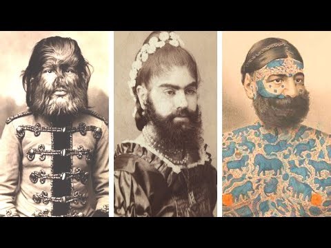 15 Circus Freaks You Won’t Believe Were Real